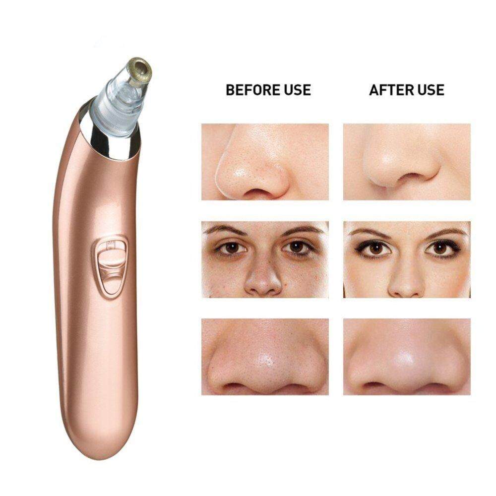 【5 Pack Free Gift 】Electric Blackhead Remover Pore Vacuum Suction Facial Acne Cleaner with 4 Beauty Probes