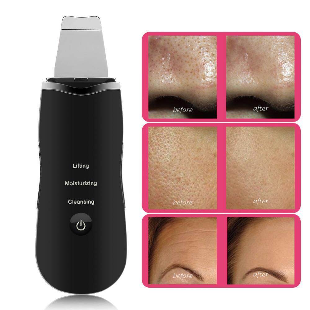 Ultrasonic Skin Scrubber Ion Facial Pores Cleaner Skin Peeling Cuticles Removal Anti Wrinkle Scrubber
