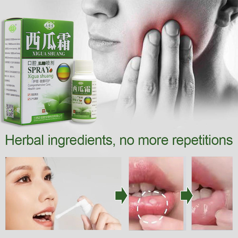 Oral Ulcer Spray Natural Herbal Mouth Ulcer Care Spray 30ml Ulser HFMD