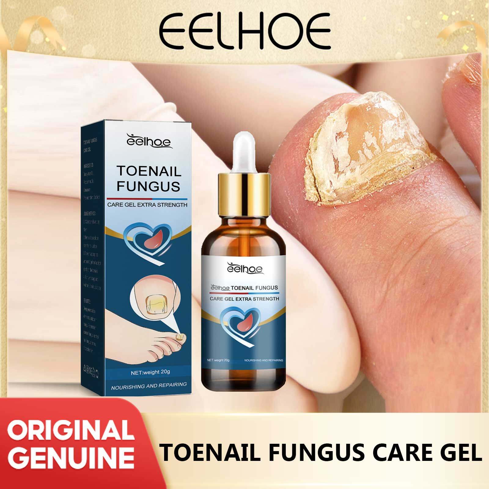 Eelhoe Nail Fungus Repair Gel Fungal Toenail Anti Infective Treatment