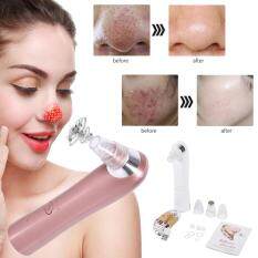 Electric Facial Skin Pore Cleaner Acne Nose Blackhead Suction Remover Beauty Machine(White)