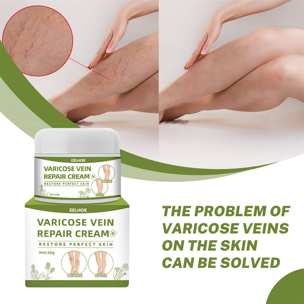 Coco Milk Eelhoe Varicose Vein Cream Venous Massage Ointment Earthworm