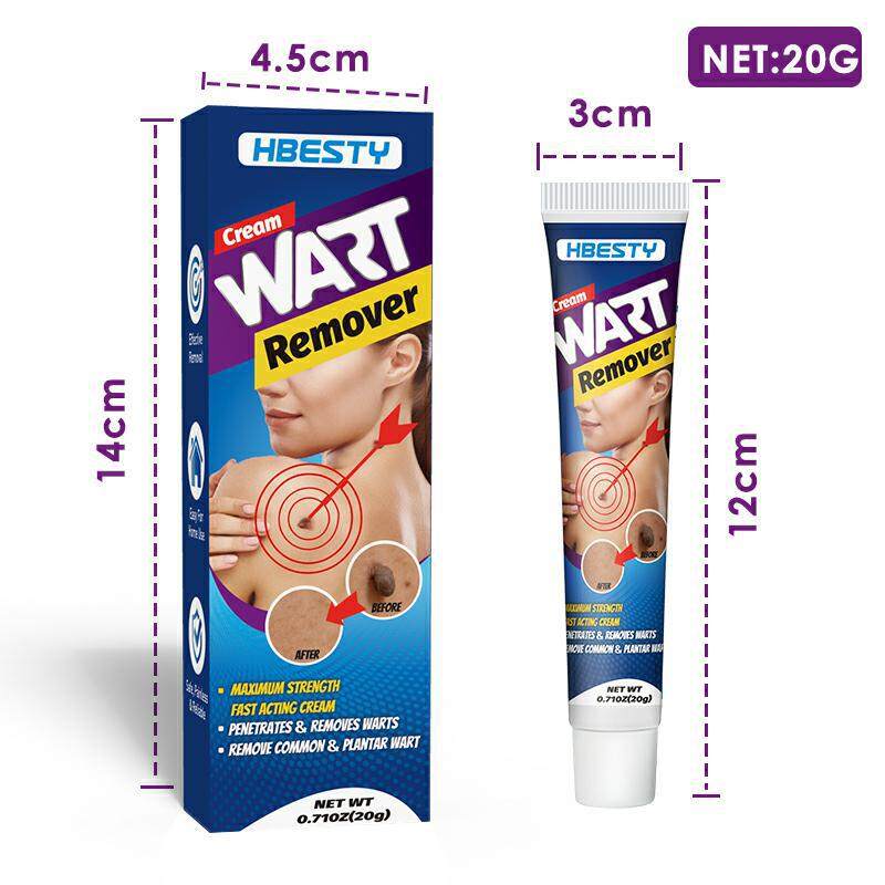 Ubat Buang Kutil Ketuat Tahi Lalat Biji Kolestrol Wart Cream Wart