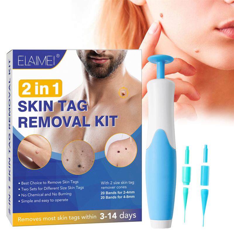 Auto Skin Tag Remover Mole Wart Remover Skin Tag Removal Kit