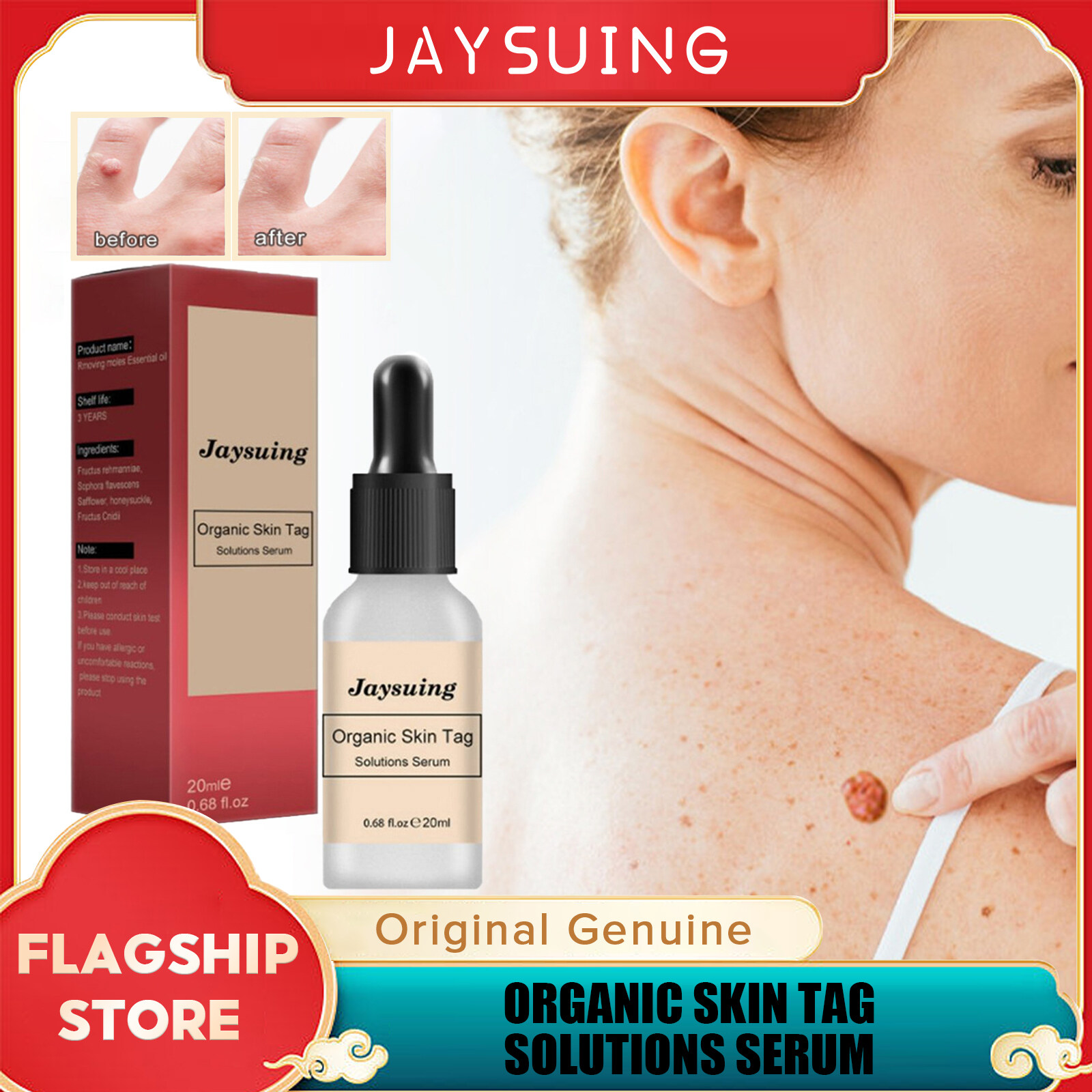 Jaysuing Organic Skin Tag Solutions Serum Effective Wart Treatment