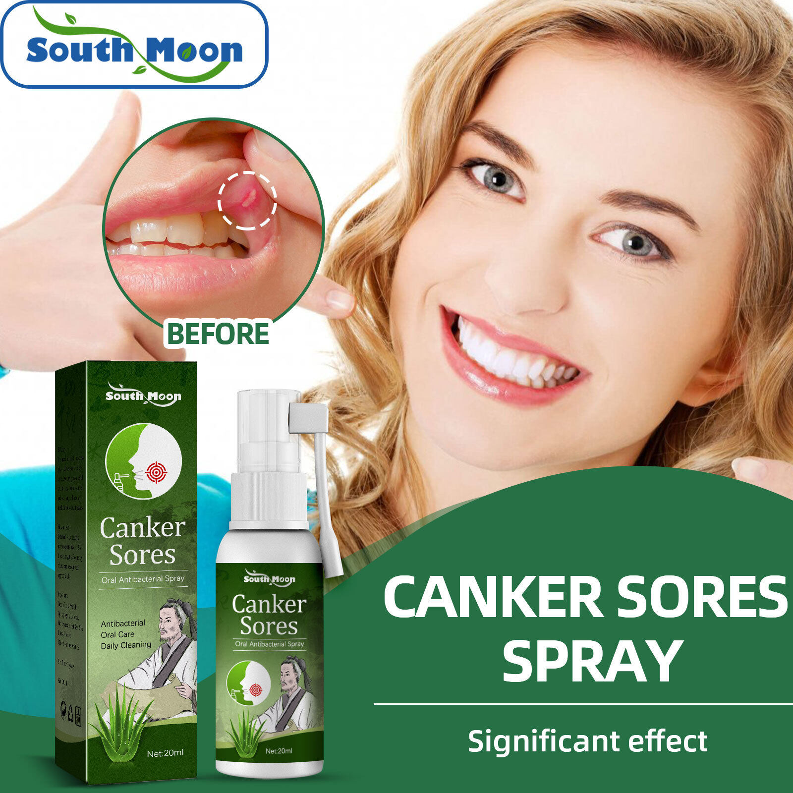 South Moon Oral Ulcer Spray Treatment Of Oral Ulcer Pharyngitis