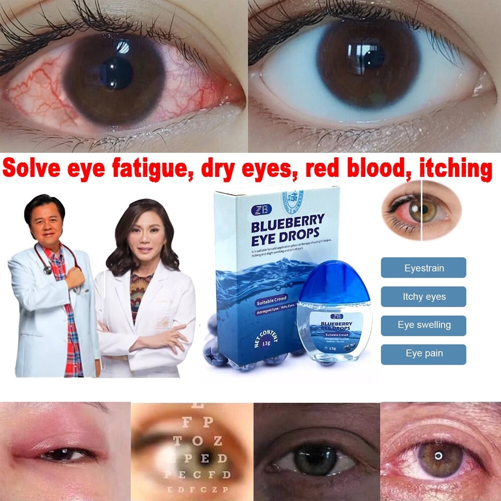 Original Blueberry Eye Drop Relieves Red Eyes Discomfort Blurred Vision