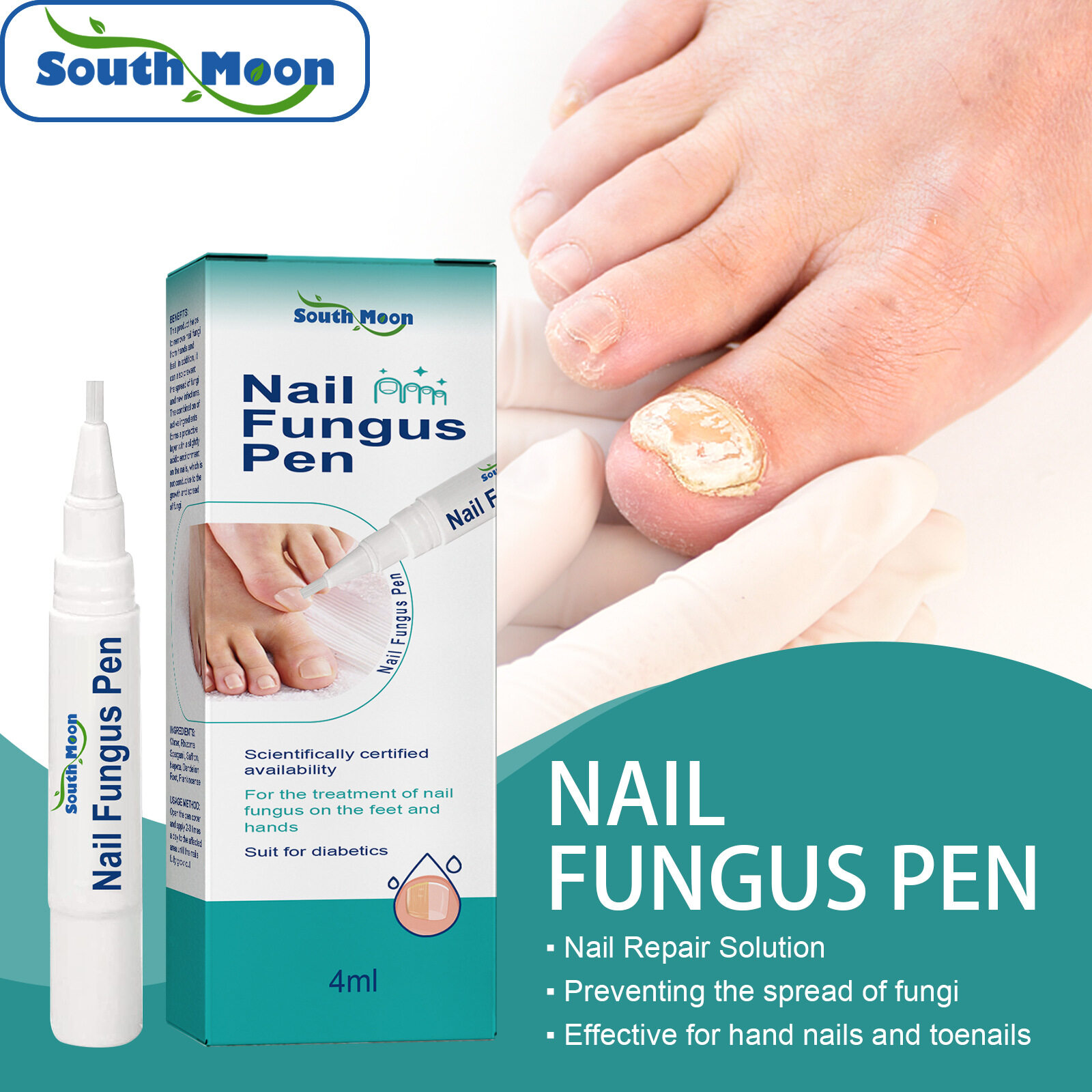 South Moon Nail Fungus Pen Paronychia Treatment Pen Toe Nail Fungus