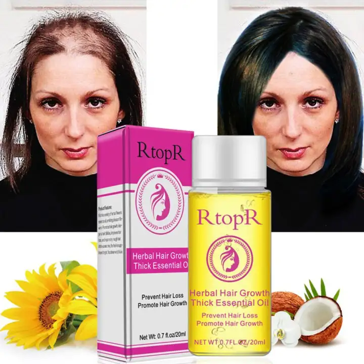Outflety Hair Growth Essential Oil Hair Serum For Hair Growth And