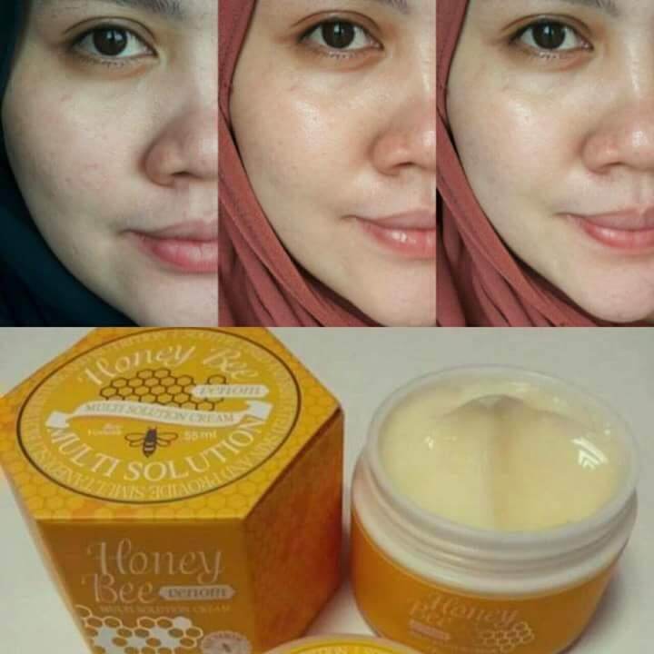 Original Honeybee Venom Moisturizer Nafura Lazada