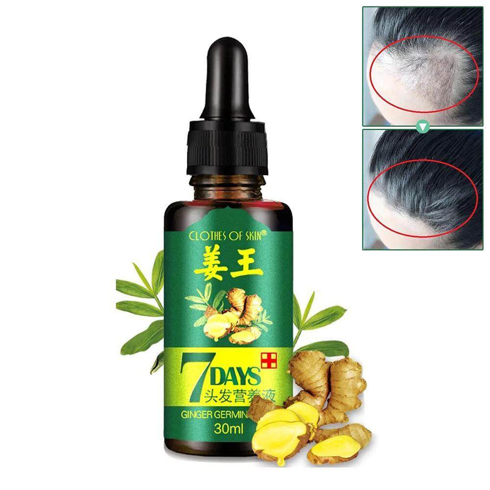 Outflety Hair Growth Oil Natural Ginger Germinal Essential Oil