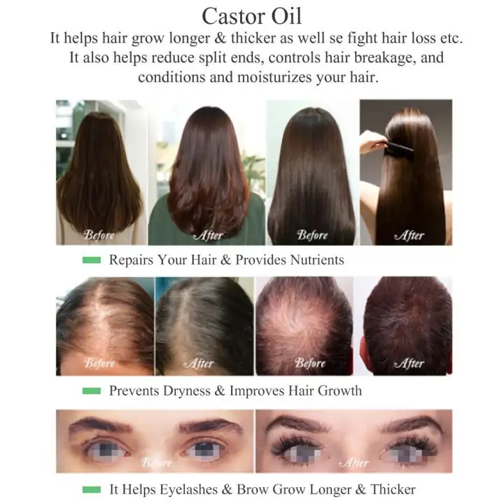 Herbal Essential Natural Castor Oil Fast Hair Growth For Hair