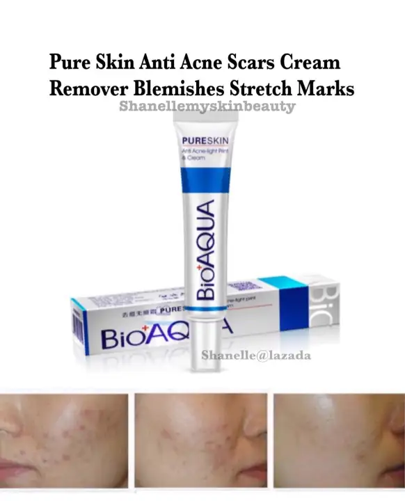 blemishes removal cream