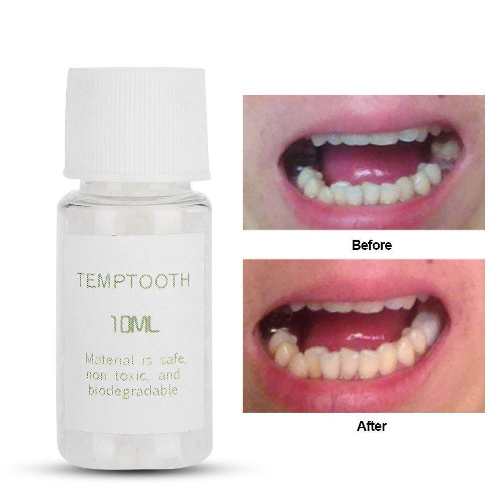 Beautytop Temporary Tooth Filling Material Temp Replace Missing DIY