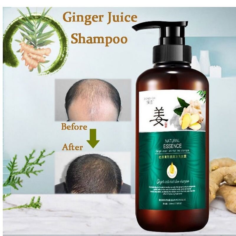 ZHENXIU Ginger Hair Booster Shampoo Conditioner Treatment Scalp Lazada