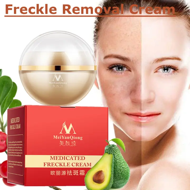 medicated freckle cream