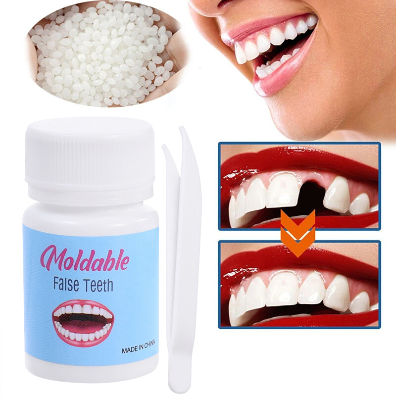 20g Resin Tooth Repair Glue Shapeable Teeth Gaps Filling Solid Glue Temporary Teeth Repair Falseteeth Glue