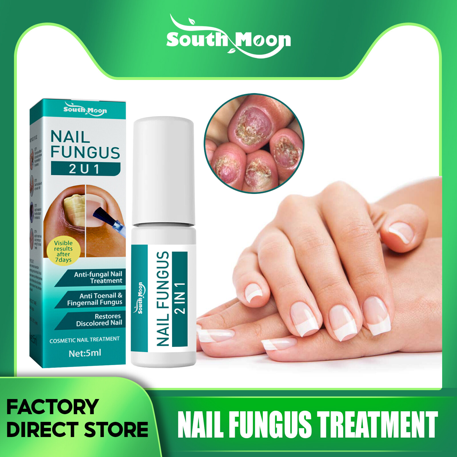 South Moon Nail Fungus Treatment Essence Serum Care Hand And Foot Care
