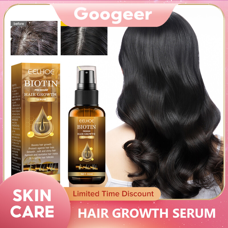 Eelhoe Biotin Hair Growth Serum Fast Growing Hair Essential Oil Hair Care Prevent Hair Loss Scalp Treatment For Men Women Ginger Hair Fast Growth Serum Spray Biotin Anti Hair Loss Prevent Essential Oils Anti-drying Baldness Treatment Hair Car(30ml