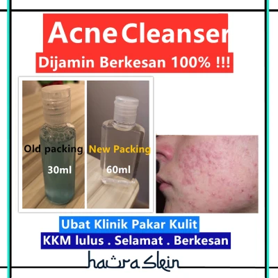 Jerawat Acne Cleanser 30ml dari Klinik Pakar Kulit Terkenal terbukti berkesan acne ubat cream serum