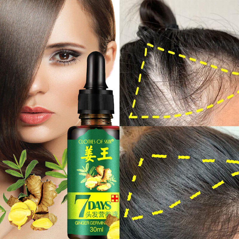 Malaysia Stock】 Original 7 Days Ginger Oil Fast Men Hair Grow Solution Hair  Fall Control Nourish Natural Hair Care Treatment Anti Hair Loss Thick Hair  Solution for Male & Female Hair Regrowth