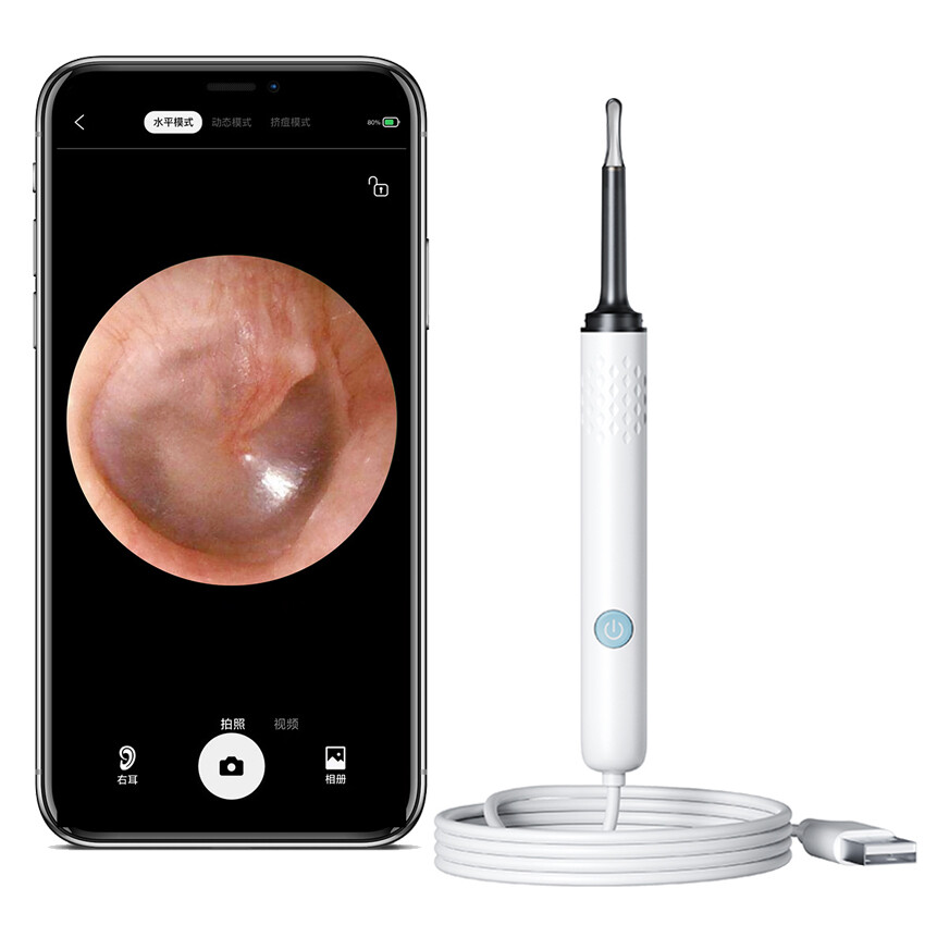 Visual Ear Pick Ear Cleaning Tool Luminous Endoscopy HD Otoscope Ear Wax Picking Spoon For IOS Android
