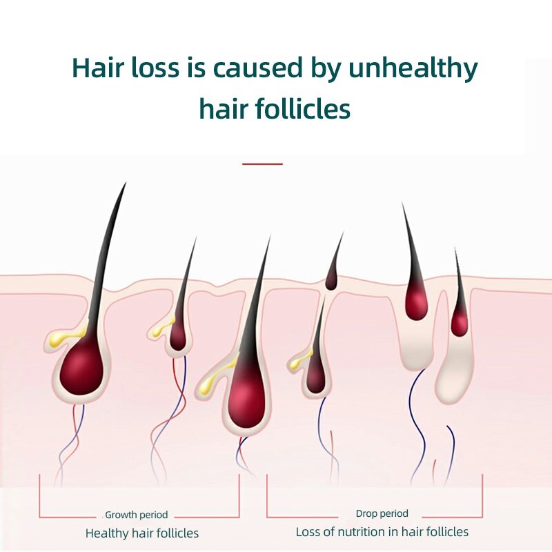 LIARTY Hair Growth Comb Negative Ion Hair Care Massage Hair Care Therapy