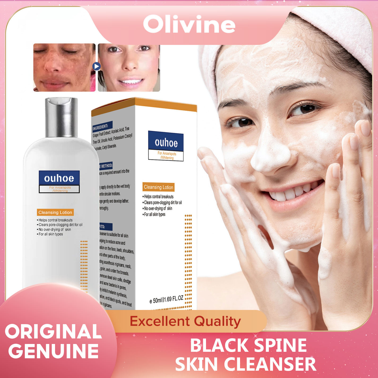 Ouhoe Black Spine Skin Cleanser Black Spine Skin Cleanser Lighten Dark ouhoe-black-spine-skin-cleanser-black-spine-skin-cleanser-lighten-dark