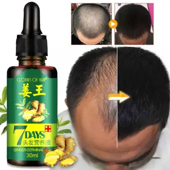 7 Day Ginger Germinal Serum Essence Oil Natural Hair Loss