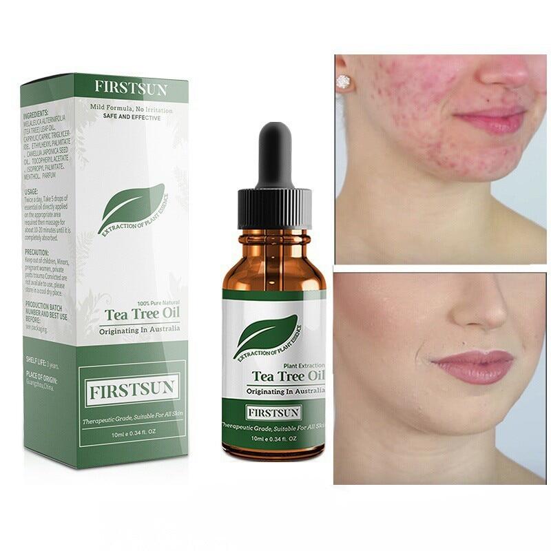 best tea tree oil for face