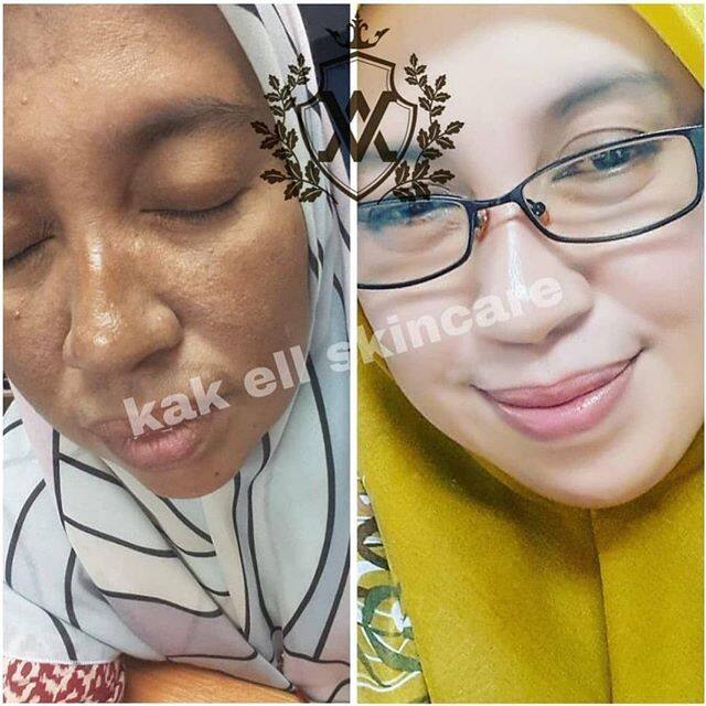 feedback kak ell skincare