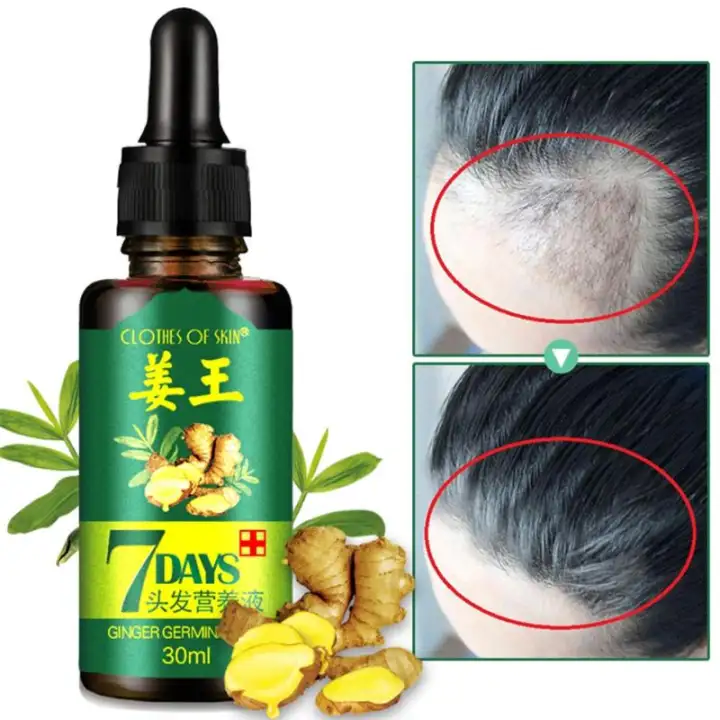 Pupup Hair Loss Treatment Ginger Hair Growth Serum For Thicker