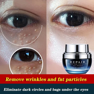 Eye cream fades eye bags under the eyes Fine lines, moisturizing, lifting, firming, anti-wrinkle student men and women 30g Remove eye bags, dark circles, reduce fine lines, lift and tighten skin