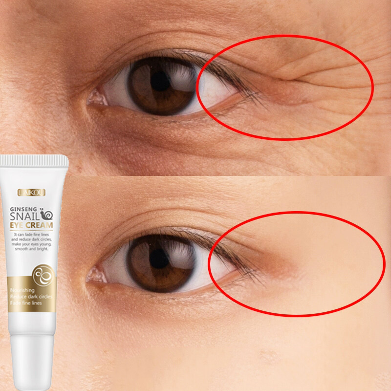 LAIKOU Red Ginseng Snail Eye Cream 15g Lazada