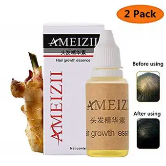 Meijie Pure Hair Growth Serum 2019 Hair Regrowth Treatment Hair