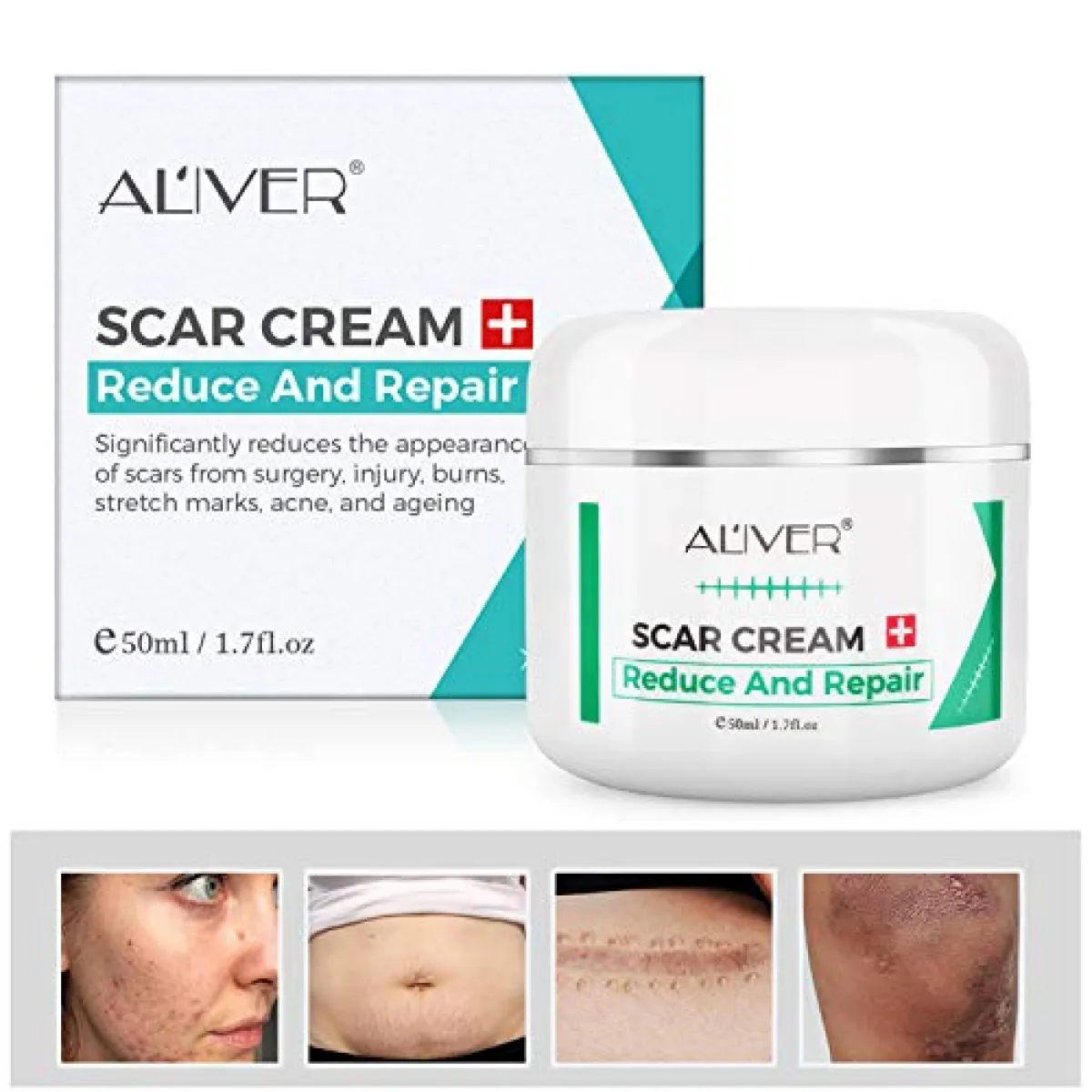 pimple marks removal cream for men