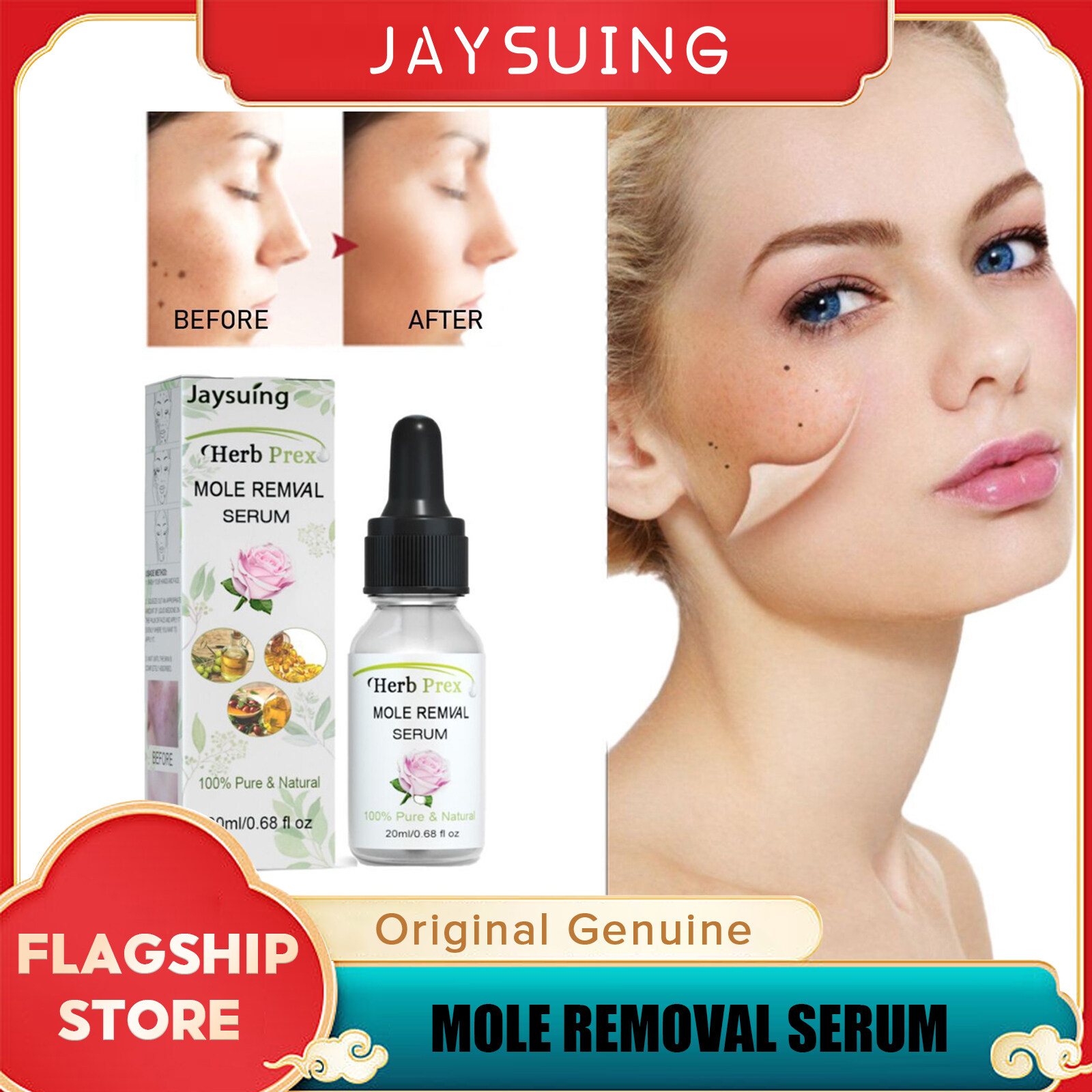 Jaysuing Wart Mole Removal Serum Organic Tags Solutions Freckle Mole jaysuing-wart-mole-removal-serum-organic-tags-solutions-freckle-mole