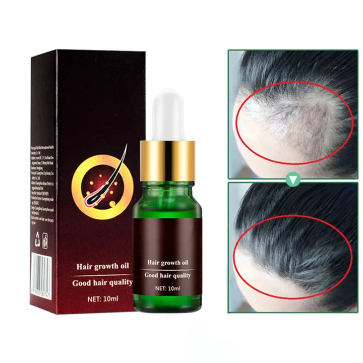 Mandarins Natural Hair Loss Hair Growth Oil No Side Effects Grow