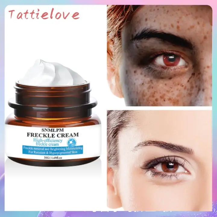 snmlpm freckle cream