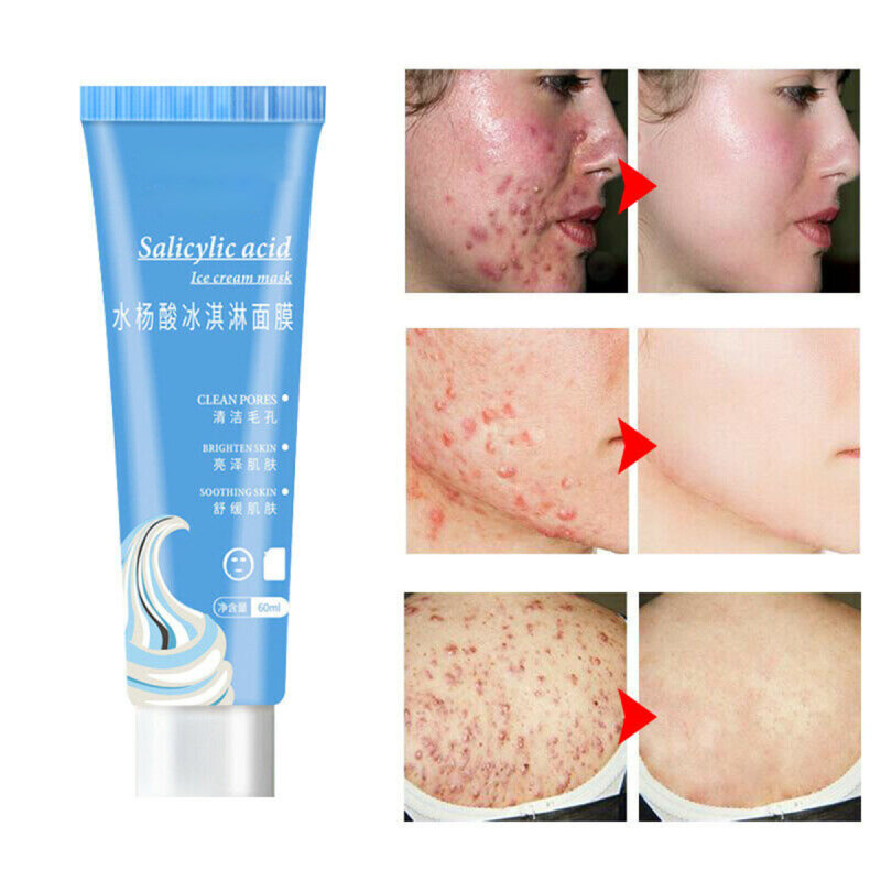 Mặt Nạ Làm Sạch Siêu Axit Salicylic Ice Cream Mặt Nạ Giảm Mụn Trứng Cá Và Mụn Đầu Đen Dưỡng Ẩm