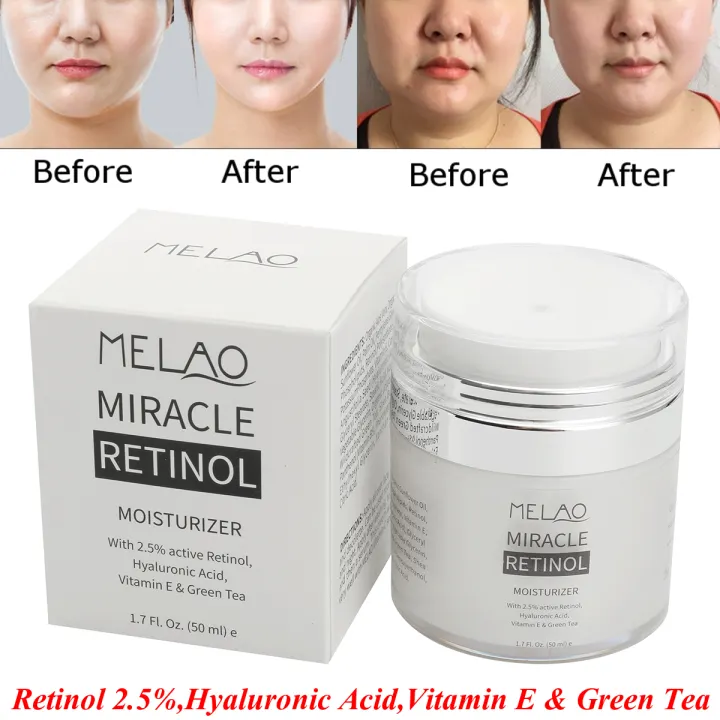 retinol miracle moisturizer