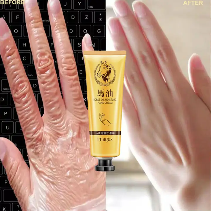 cream for peeling hands