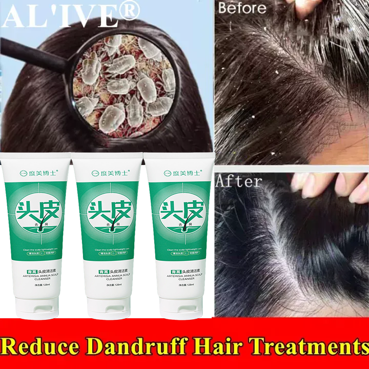 Scalp cleansing shampoo effectively solves dandruff itchy scalp