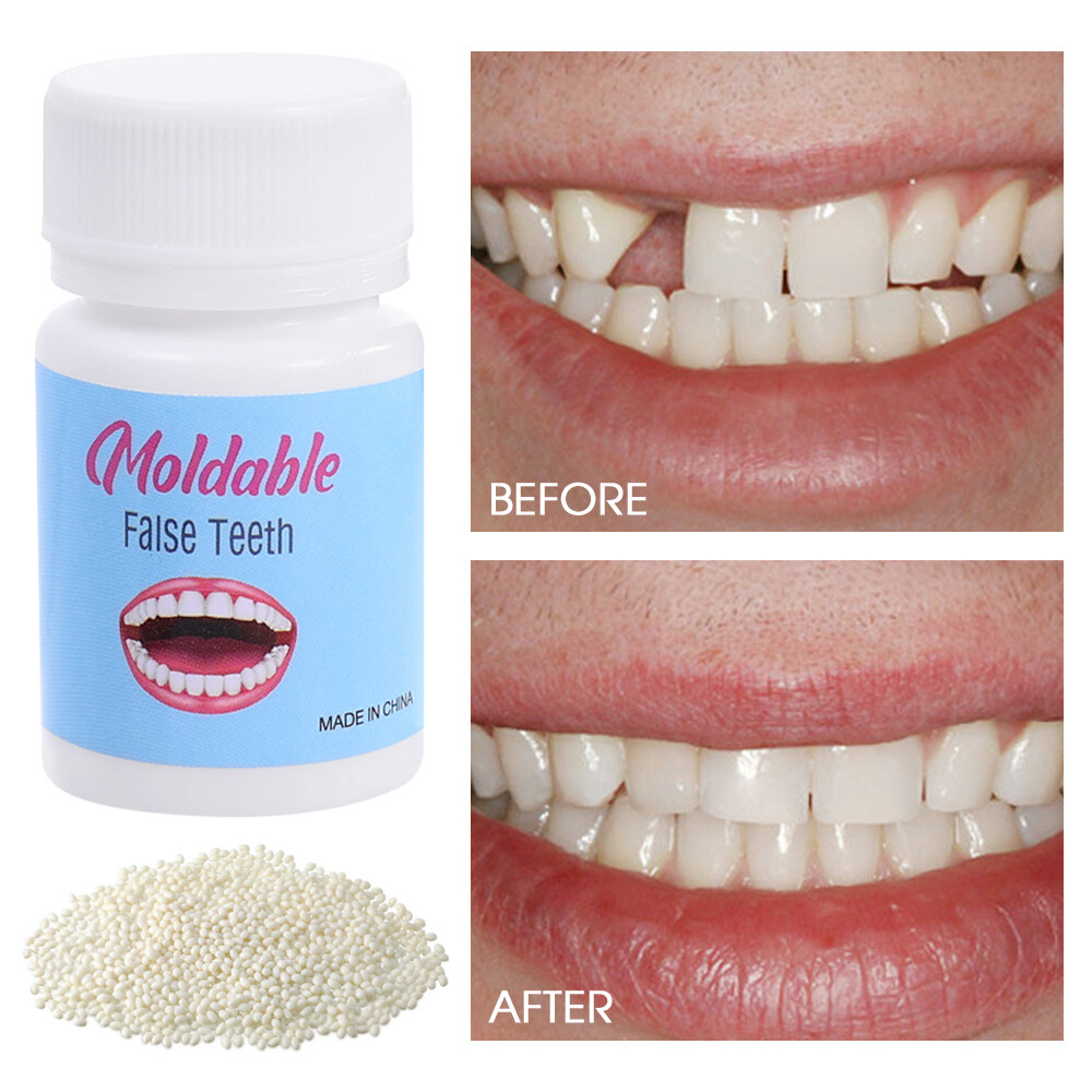 Resin Tooth Repair Glue Shapeable Falseteeth Gaps Filling Solid Glue Temporary Fake Teeth Repair Glue Safety Dental Supplies