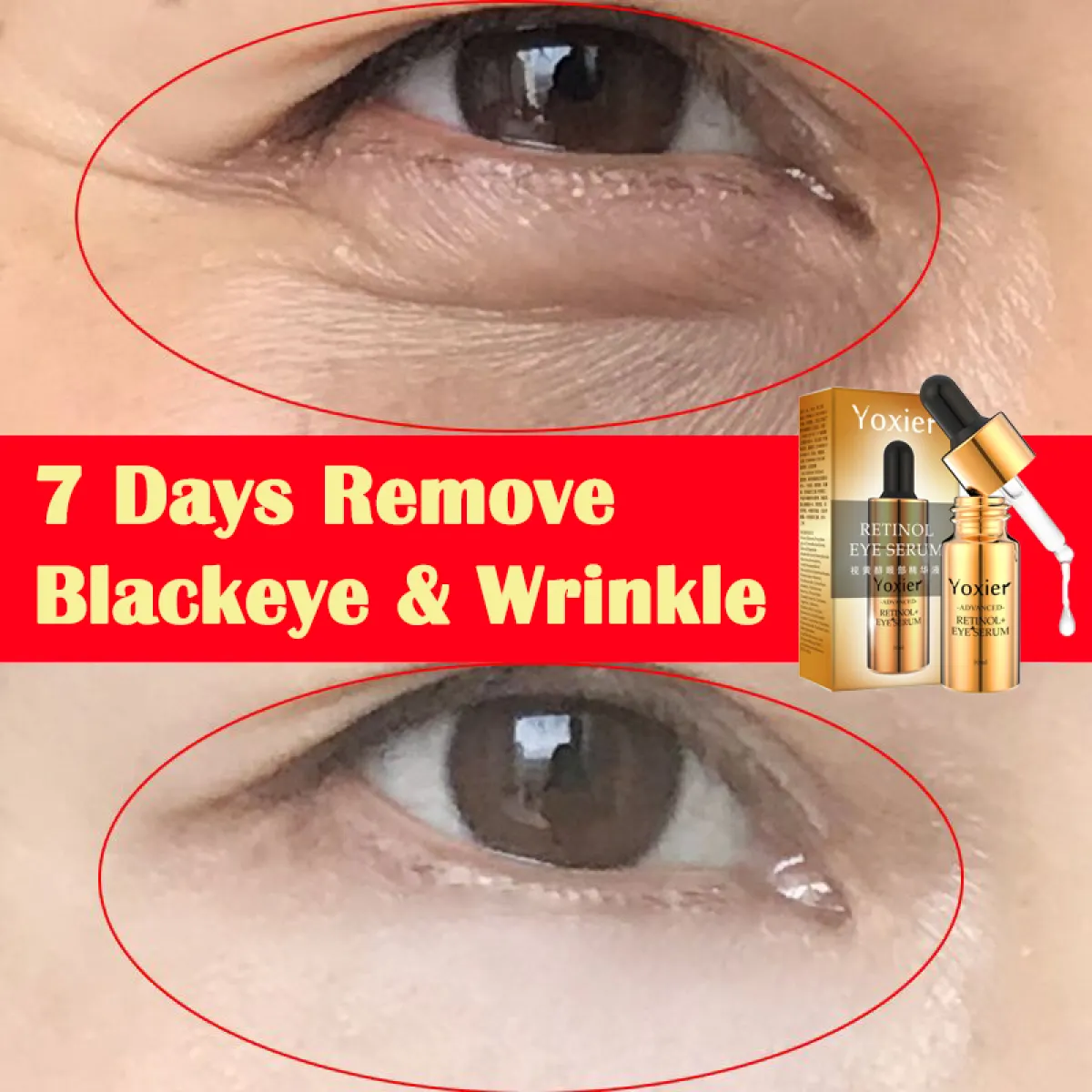 yoxier eye cream