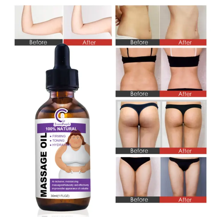 stretch mark cellulite cream