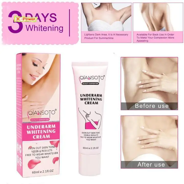 knee bleaching cream