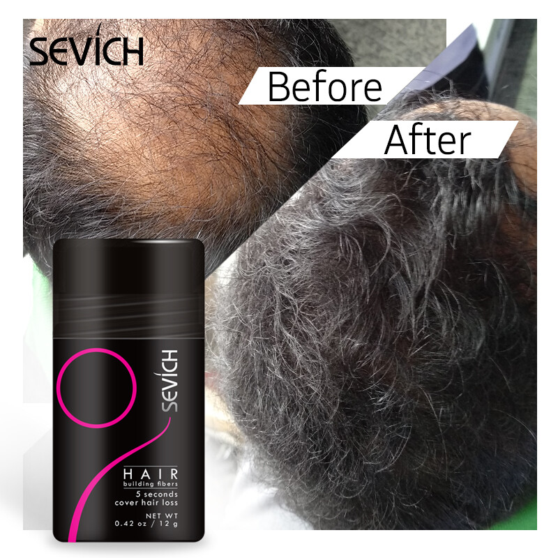 SEVICH Hair Building Fiber 12g Black Hair Fiber