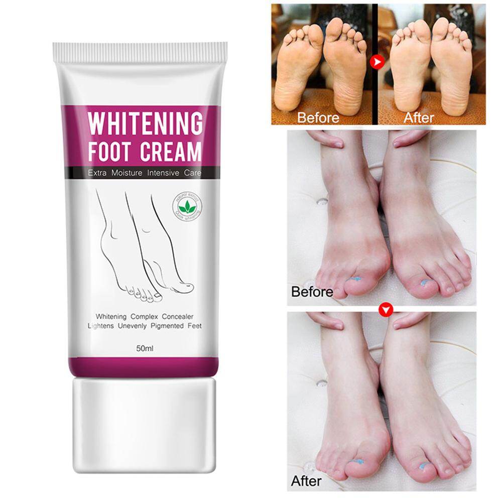 leg foot crack cream