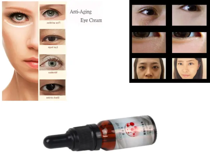 niacinamide for dark circles